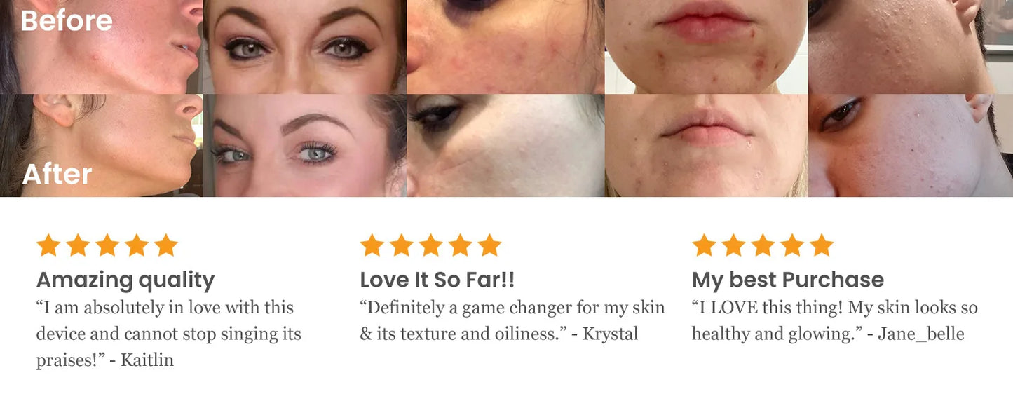 Professional High Frequency Facial Machine Electrotherapy Wand Glass Neon Argon Wands Remove wrinkles Inflammation Acne Skin